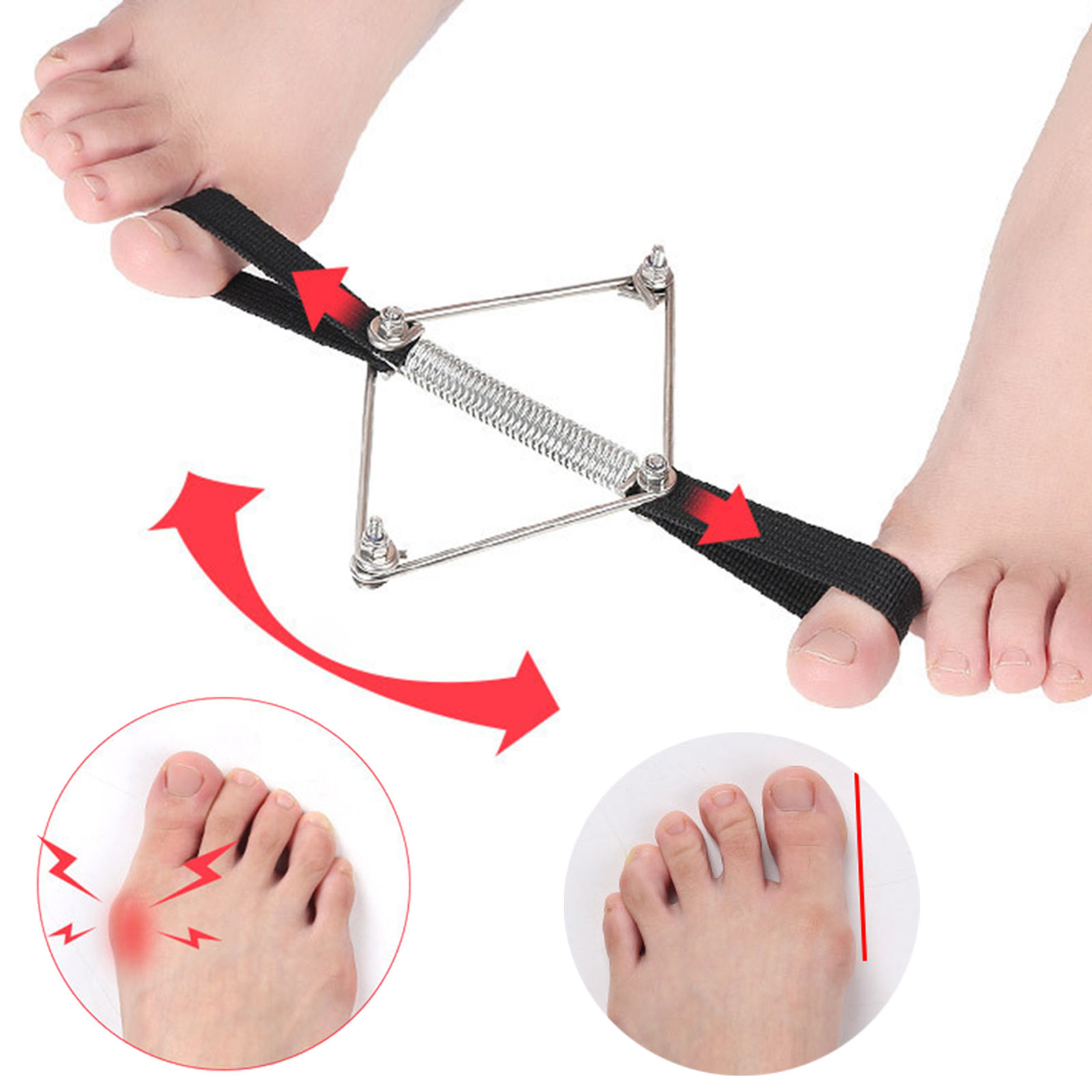 Pilates Yoga Wellness - Bunion Corrector Nylon Thép Mềm Mũi